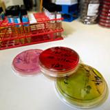 Американские ученые заявляют: крах эры антибиотиков можно предотвратить