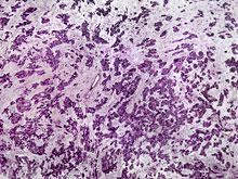 ������� ����� ����� ��������� ��������� �� ���� ��������� ��������