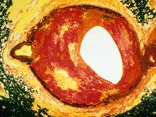 ������������ ������� ������������� ��� ��������, ������� ������