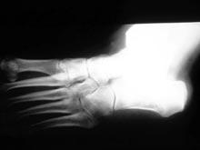 ���������� �������� ������� ��������� ����� ����� ������ � ������������