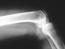 ��������� ����� ������� ����� - ������� ����������� ���������, ������� ��������