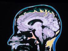 ��������� �������������� ����� �������-�������� ������ ����������, ������� ��������