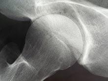 ������ ����������� ��������������� ��������� ���������� �������