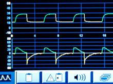 � ������� ��������� ������� �������������� ����������� ���������