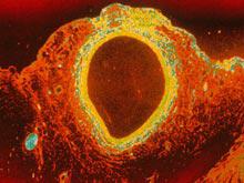 ������� ������� �������� ������ � ������ ���� � �������� �����