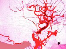 ������������������ ������������ ����������� ���� ��������� � ���������