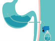 ������������ �������, ��������� �� ���� ������ ����, ����� ������� ������ �����������