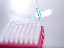 ����� ���������� ����������� ���������� ��������� � �������