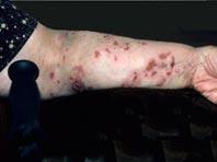 ������ ������������ ������������ �������� �����, ������� �����������