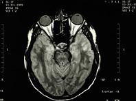 ���������� ����� �������� �������� ������