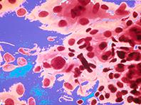 ������������� �������� ������� ����� ������ ������ � �����