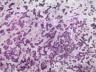 ���������� ��� ������ ����� ����� ������� ������������� �������