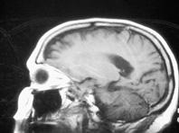 �������� �������� - �������� ������� ���������� � ��������