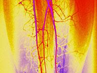 ����������� �������� �������� ������� � ��������� ����������