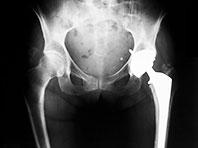 ���������� ��������������� ��������� ��������� ��������� � ��������