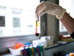   :   Theranos