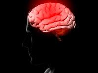 Исследователи заглянули в мозг психопатов