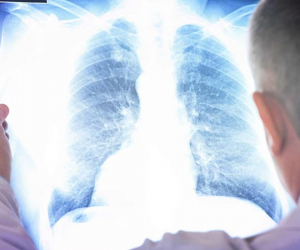 Невидимая угроза или надуманный страх: что скрывают настоящие дозы облучения при рентгене и флюорографии