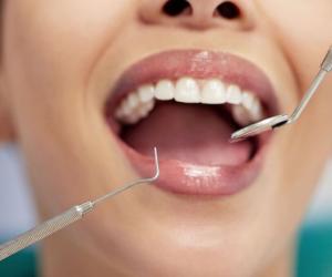 Секрет сладкой жизни: ученые рассказали, когда конфета не вредит вашим зубам