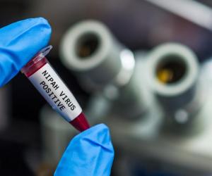 Кровь из глаз и десен: смертельный вирус Марбург добрался до туристов, ученые бьют тревогу